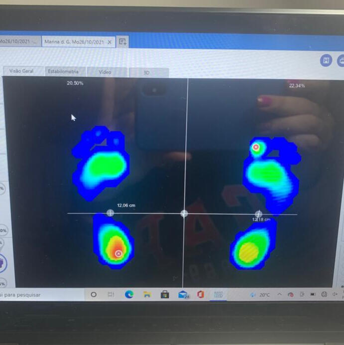 Instituto de Fisioterapia Hellen Caroline pilates, fisioterapia, RPG, palmilhas, massagem, drenagem linfática, liberação miofascial, acupuntura, ventosaterapia, disfução ATM no Brooklin zona sul de São Paulo